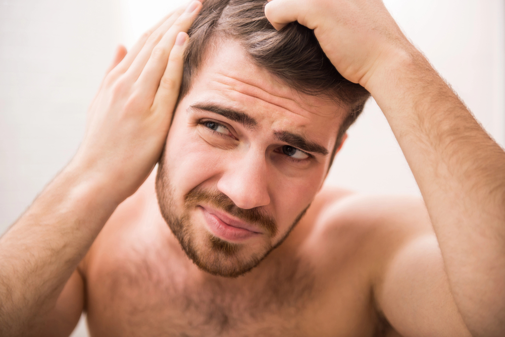 male pattern baldness, steroids and hair loss